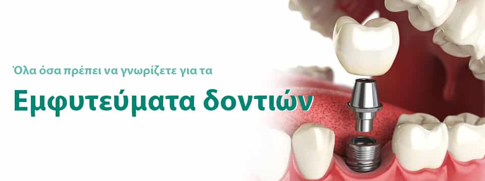 εμφυτεύματα δοντιών σε ιατρείο στην Θεσσαλονίκη